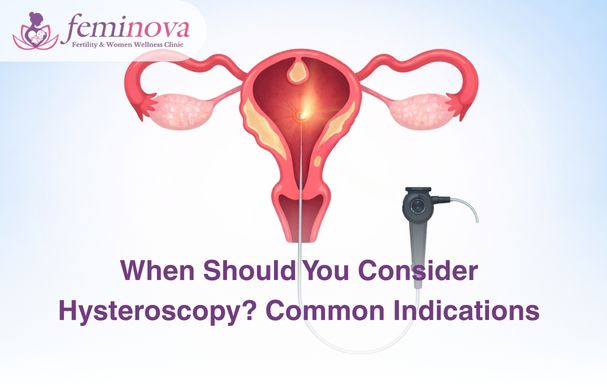 When Should You Consider Hysteroscopy Common Indications When Should You Consider Hysteroscopy? Common Indications To Know